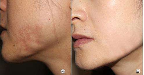 山東哪家整形醫(yī)院口碑好且專業(yè)？