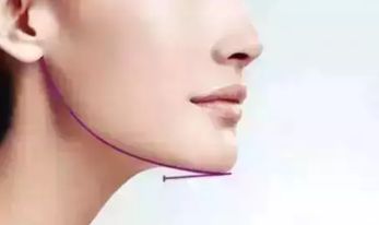 成都醫(yī)美做唇部哪家醫(yī)院好？找到這家醫(yī)院，告別唇部問題的困擾！