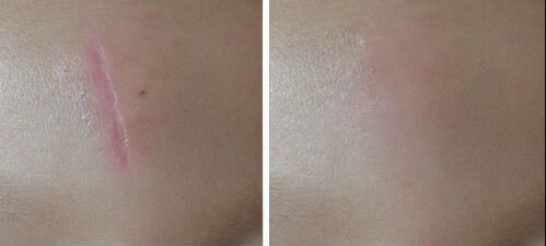 上海哪家整形醫(yī)院鼻子修復(fù)技術(shù)好