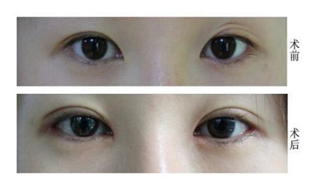 桂林有哪些去痘療效好的醫(yī)院值得推薦？