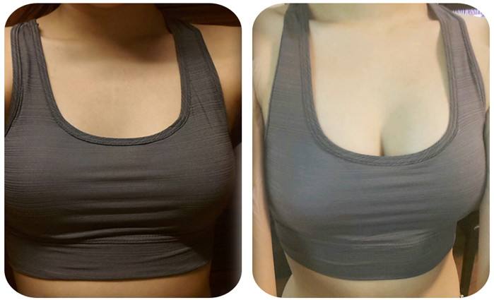 2023鄭州切除祛靜態(tài)紋正規(guī)專家榜單前十強(qiáng)(蔡亮、楊智勇、王和平價(jià)格收費(fèi)公開)