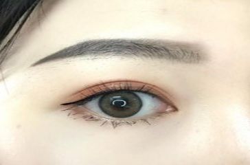 上海去黑眼圈哪個醫(yī)院好？專家推薦的實力醫(yī)院排行榜