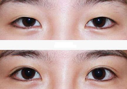 北京哪家激光祛痘醫(yī)院好？選擇正規(guī)醫(yī)療機(jī)構(gòu)，實(shí)力專(zhuān)家團(tuán)隊(duì)等你來(lái)解答