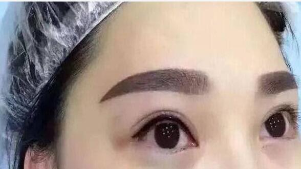 北京史三八整形醫(yī)院李珠賢紋眉口碑評價如何？