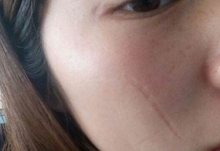 濟(jì)南哪家醫(yī)院做豐胸效果好？排名靠前，技術(shù)專業(yè)的有哪些？