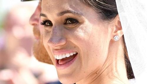 2023鄭州玻尿酸打唇紋前十位醫(yī)生強榜(李士成、魏星、于永梅醫(yī)生信任度很高！)