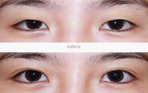 東莞哪家醫(yī)院的祛斑效果最好？一文揭秘東莞祛斑好醫(yī)院及其獨(dú)特療法