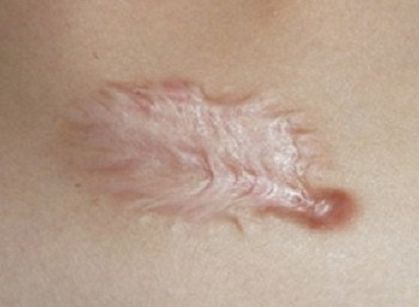 海南去雀斑哪家醫(yī)院好？探尋海南最受歡迎的雀斑祛除醫(yī)療機(jī)構(gòu)