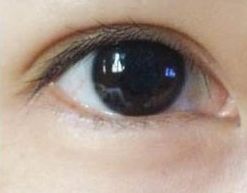 蘇州哪家祛痘醫(yī)院好？專家推薦的治療痘痘效果好的醫(yī)院