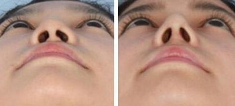 蘭州美容好的醫(yī)院是哪家？挑選最適合你的蘭州美容醫(yī)院