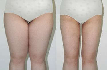 南京雀斑祛除十強診所：專業(yè)技術(shù)，效果顯著