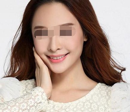 打玻尿酸后可能產(chǎn)生僵硬感？使用玻尿酸有哪些風(fēng)險(xiǎn)？