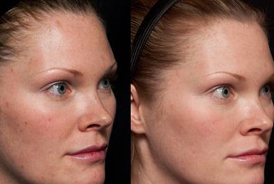 河北醫(yī)大牙科門(mén)診價(jià)格查詢(xún)，口腔種植牙費(fèi)用多少？