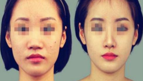 養(yǎng)成美鼻的6個關鍵步驟，完美修復效果在您的掌握！