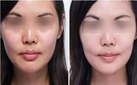 陰道緊縮效果持久嘛？讓你持續(xù)享受緊致感