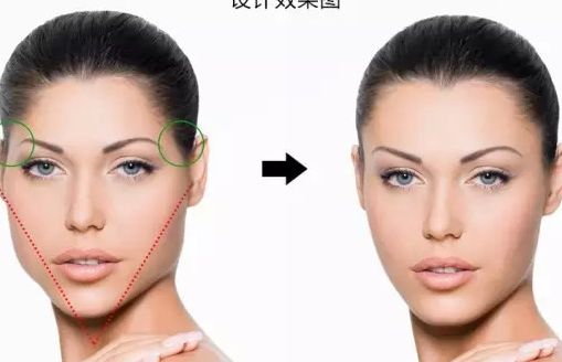 瘦身美容，腹部吸脂手術(shù)可顯著減掉多少腰圍呢？