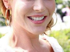 眼袋整形手術(shù)費(fèi)用及去除后是否有風(fēng)險