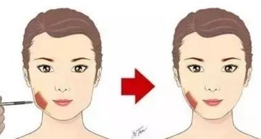 專業(yè)雙眼皮手術(shù)修復(fù)，3大關(guān)鍵原則揭秘