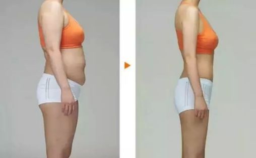 注射隆鼻需求調(diào)查：不同類型隆鼻材料比較