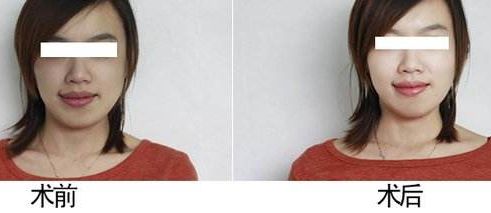 打響唇妝靚麗一招，打造自信笑容就靠它！