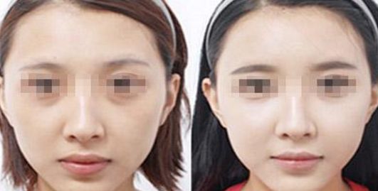 容城洗牙價(jià)格一覽，潔牙需花多少錢？