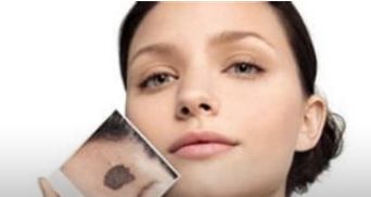 透明質(zhì)酸隆鼻如何改變?nèi)蓊?/>
                                </a>
                                <h4><a href=