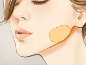 彩光嫩膚：有效去除紅血絲的好方法！