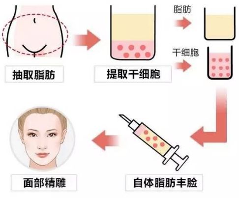 有效美白祛斑方法匯總，專業(yè)醫(yī)美與低成本自制全覆蓋！