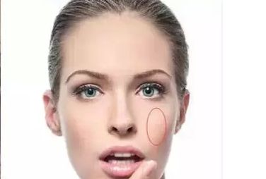 去除痘印的絕妙方法，告別暗沉小臉，揭秘4招新技巧