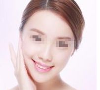 恢復女性魅力，重塑挺翹胸部的矯正方法