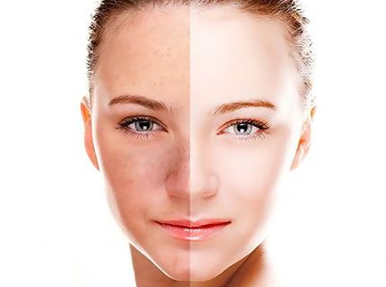 一顆種植牙所需費(fèi)用及恢復(fù)時(shí)間介紹