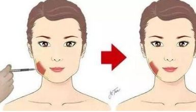 腰部吸脂術(shù)的療效如何？