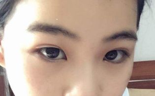 烤瓷牙的優(yōu)勢與劣勢，如何選擇？