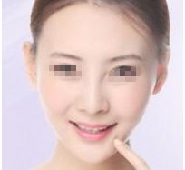 私密之處整容多貴 探析價格因素