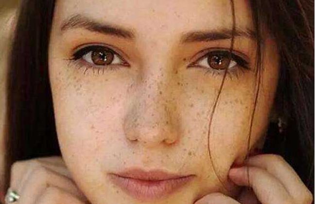 內(nèi)眼角手術(shù)術(shù)后幾天可拆線，拆線時間詳解