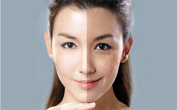 隆鼻手術(shù)后恢復(fù)需要多長(zhǎng)時(shí)間？術(shù)后注意事項(xiàng)詳解！