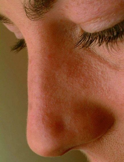 面部整形改變了許多人的生活態(tài)度，你知道哪些整形手術(shù)適合男性呢？