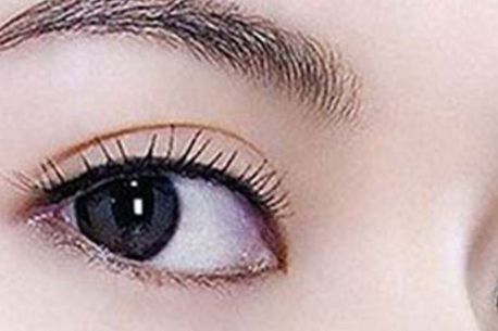 激光去除魚(yú)尾紋的優(yōu)勢(shì)與術(shù)后護(hù)理全解析！