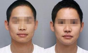 擁有瓜子臉特點的人有哪些？