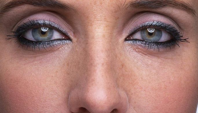 修復(fù)上眼臉下垂手術(shù)后的恢復(fù)時(shí)間