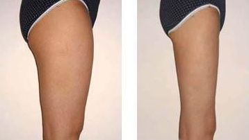 如何有效預(yù)防眼角皺紋，給你的眼部肌膚帶來(lái)長(zhǎng)久的保護(hù)