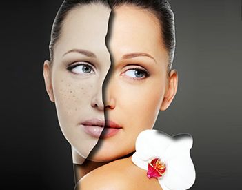 北京雙眼皮修復(fù)的效果如何？什么狀況需要做雙眼皮修復(fù)？