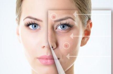 光子嫩膚后，肌膚是否會變得敏感？