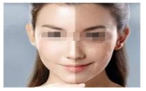 吃海鮮對(duì)于使用瘦腿針的人來說是否適合？