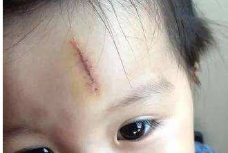 成都哪里做拉皮手術(shù)效果好，八大處、晶膚、嬌點等5家備受推薦