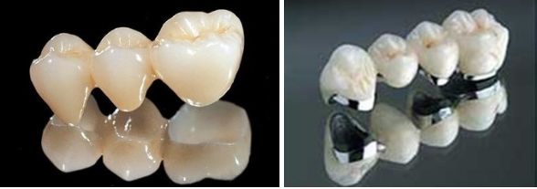 修補處女膜的手術(shù)方式和應(yīng)考慮的因素