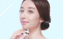 雙眼皮修復(fù)，選對時機，展現(xiàn)美麗眼眸