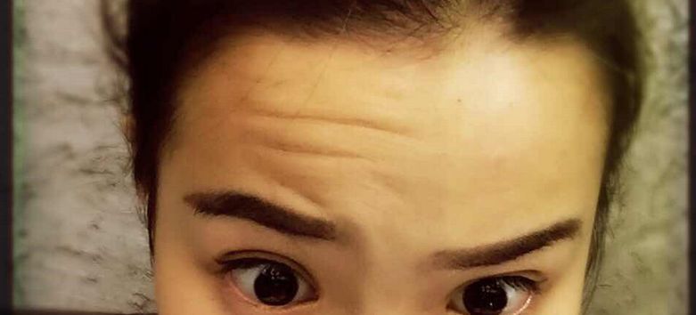 超聲波去眼袋：效果持久還是短暫？