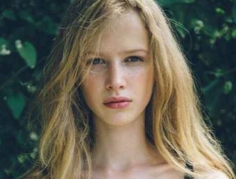 下頜骨整形后應該注意什么？