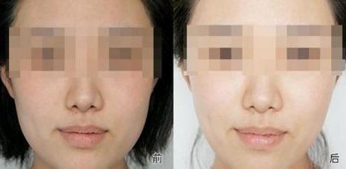 有效改善黑眼圈的飲食和作息調(diào)整方法！